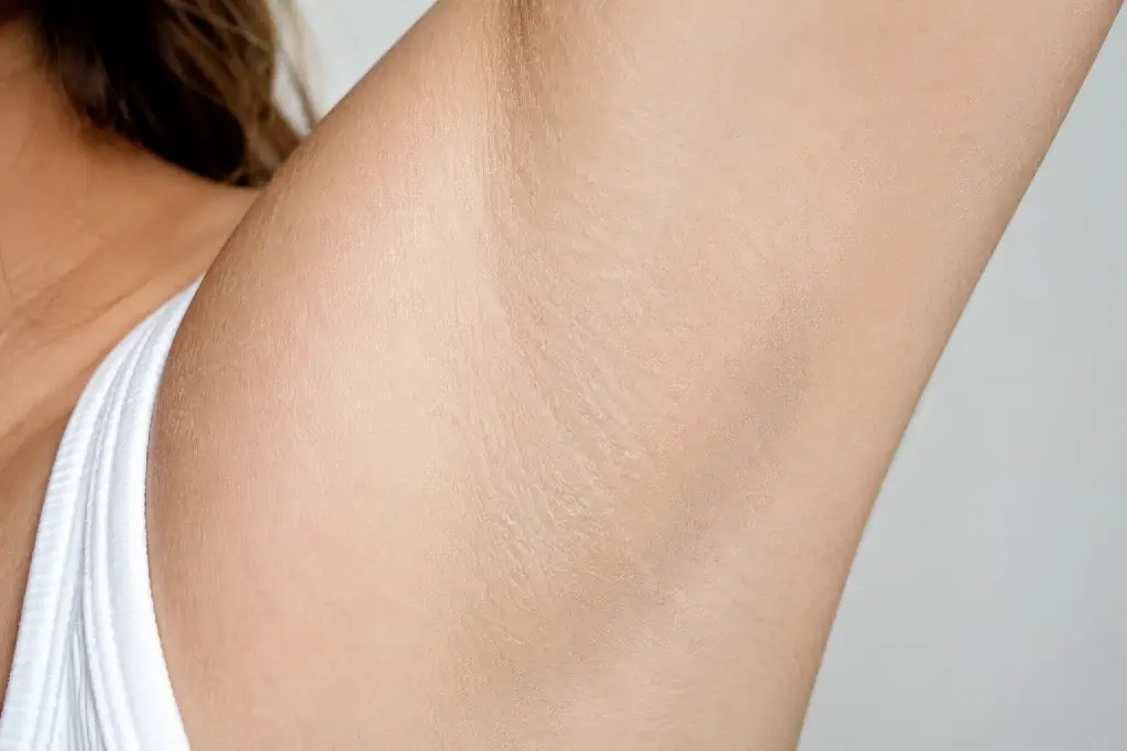 Healthy underarm skin with no rash despite itchy underarms