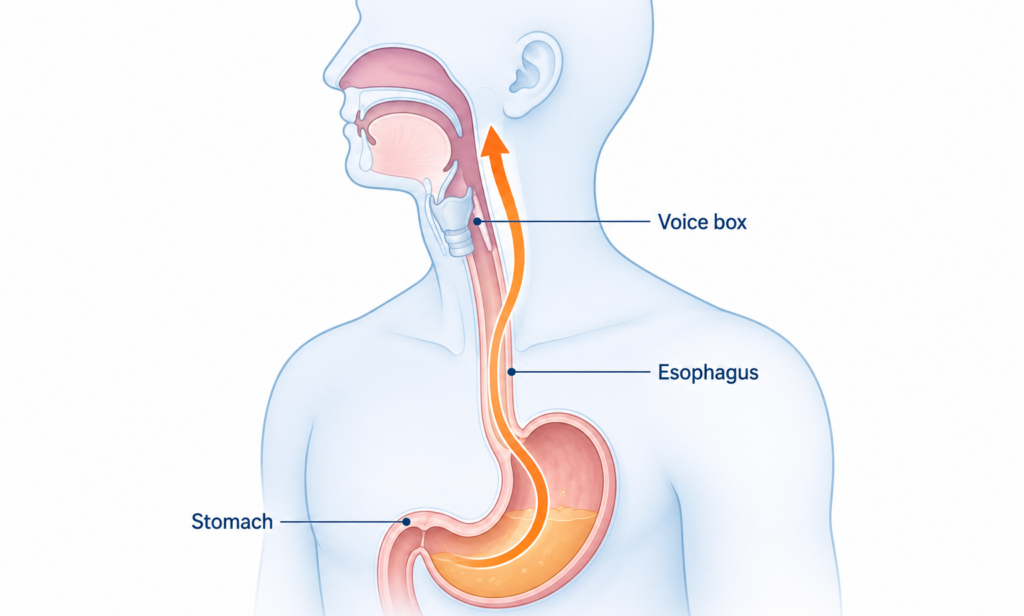 How Silent Reflux Differs From Regular Acid Reflux