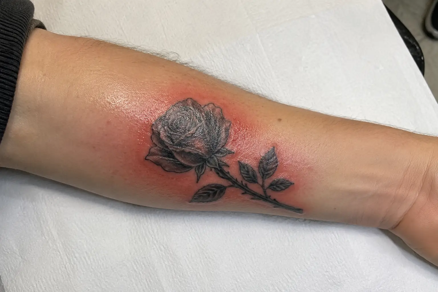 Infected Tattoo Signs Symptoms and How to Treat It
