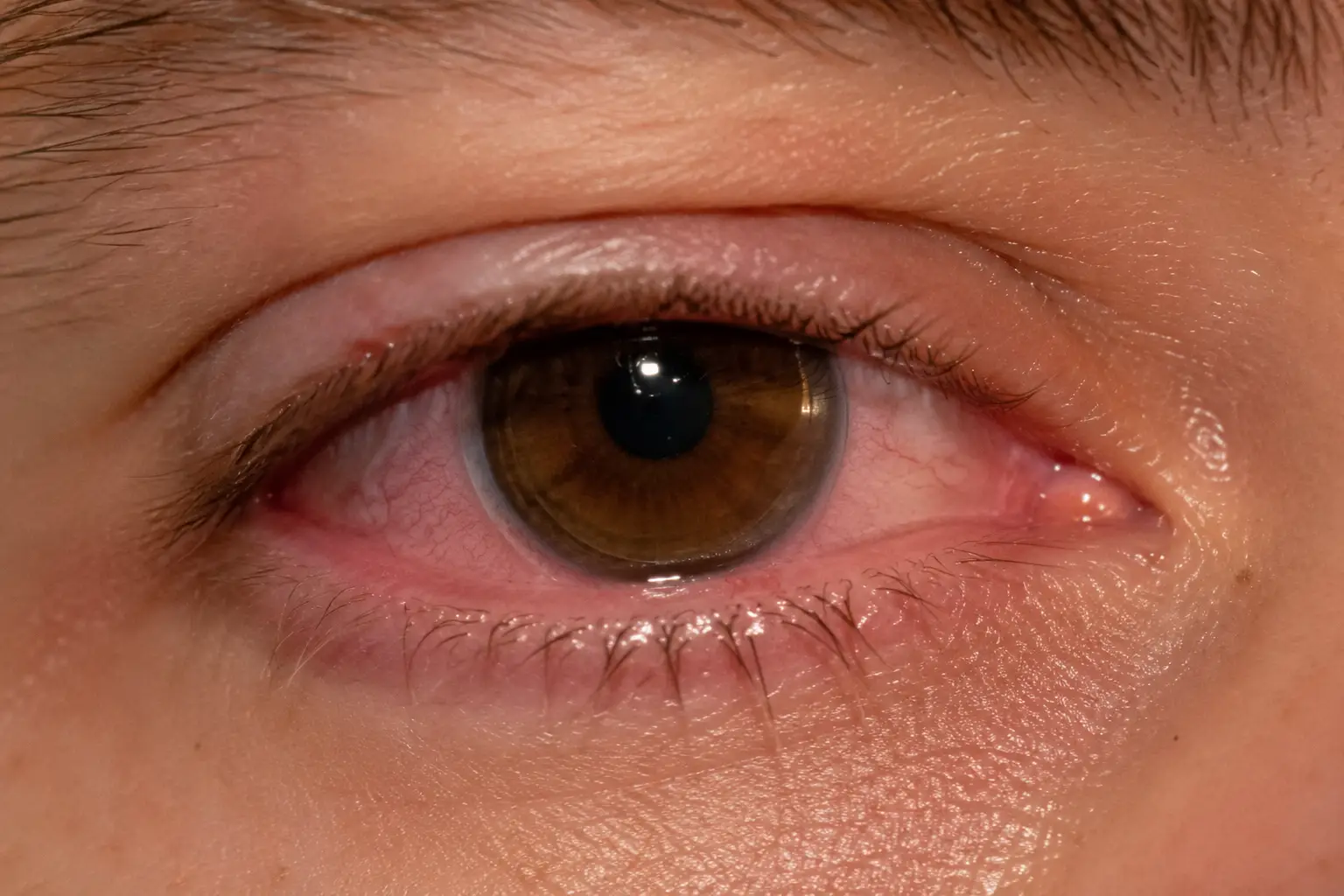 can you sleep with contacts in