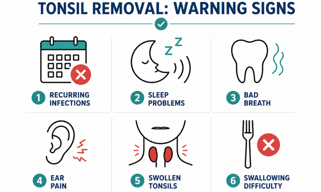 signs you need your tonsils removed as an adult checklist