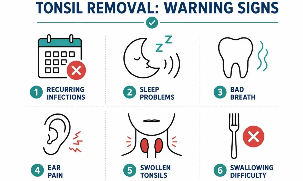 signs you need your tonsils removed as an adult checklist