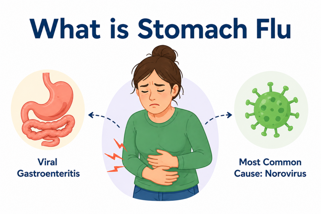 what is stomach flu