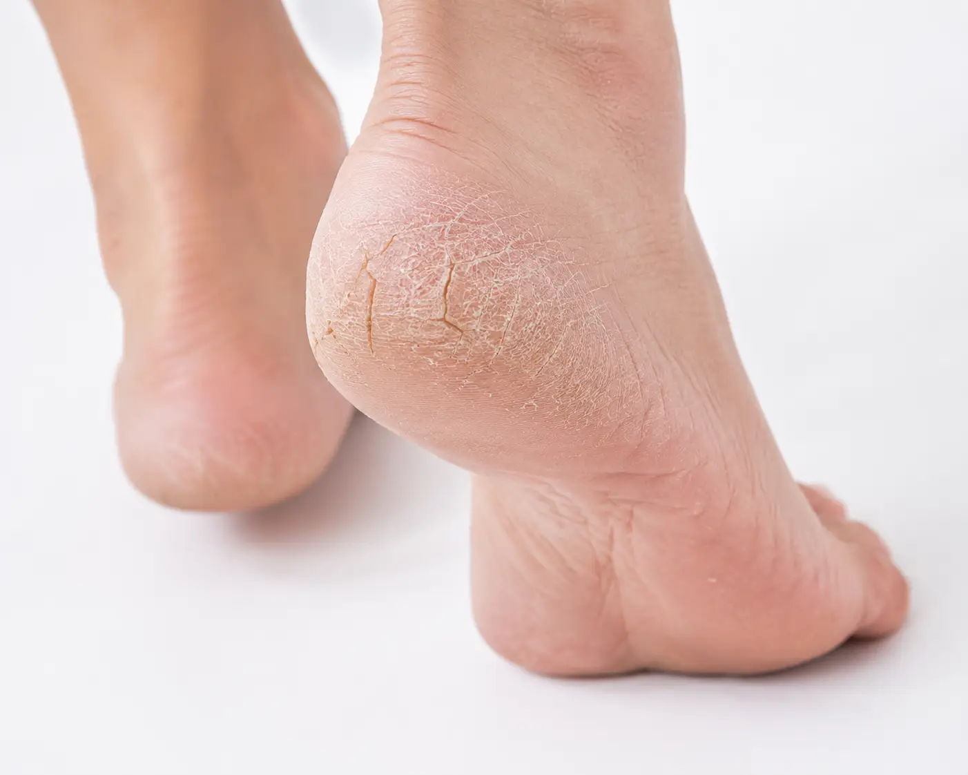 why are my feet itchy